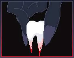 Uncover the Dark Secret of "The Tooth": A Beginner's Guide to a Creepy Indie Gem